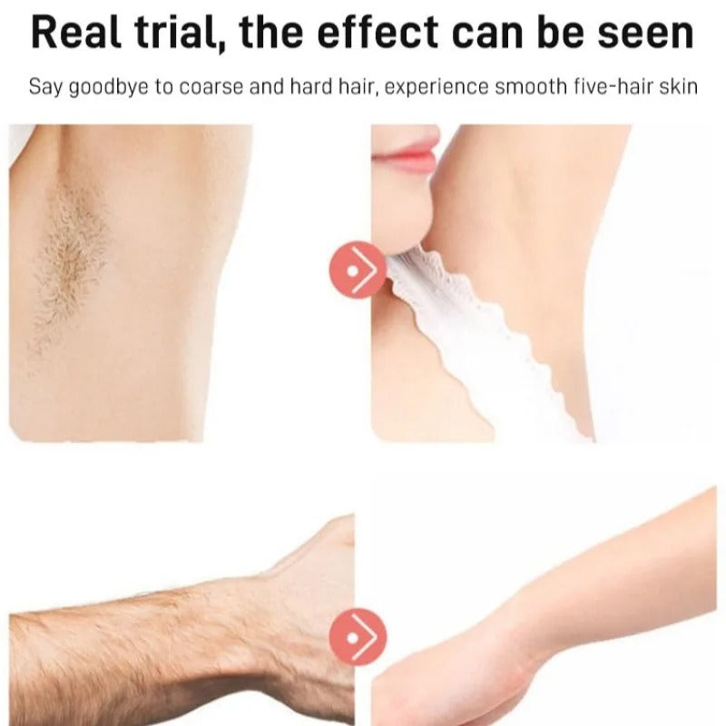 Rechargeable Epilator Hair Removal