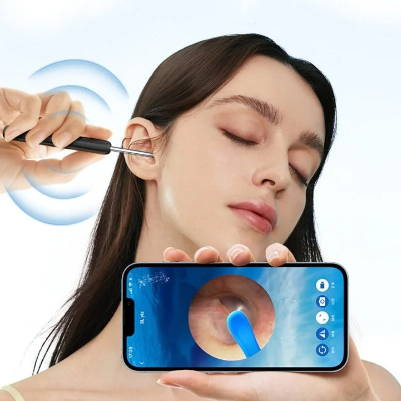 C6 Wireless Visual Removal Tool with HD Camera Smart Ear Cleaning Otoscope